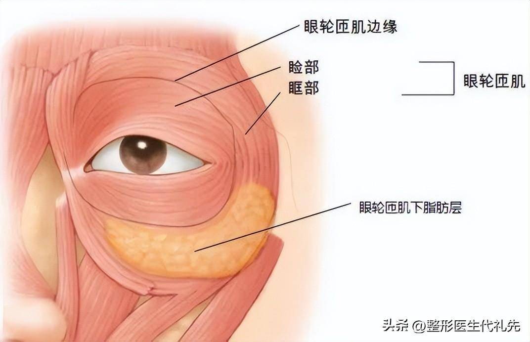 眼袋與卧蠶的區别，卧蠶哪種填充材料效果要更好？