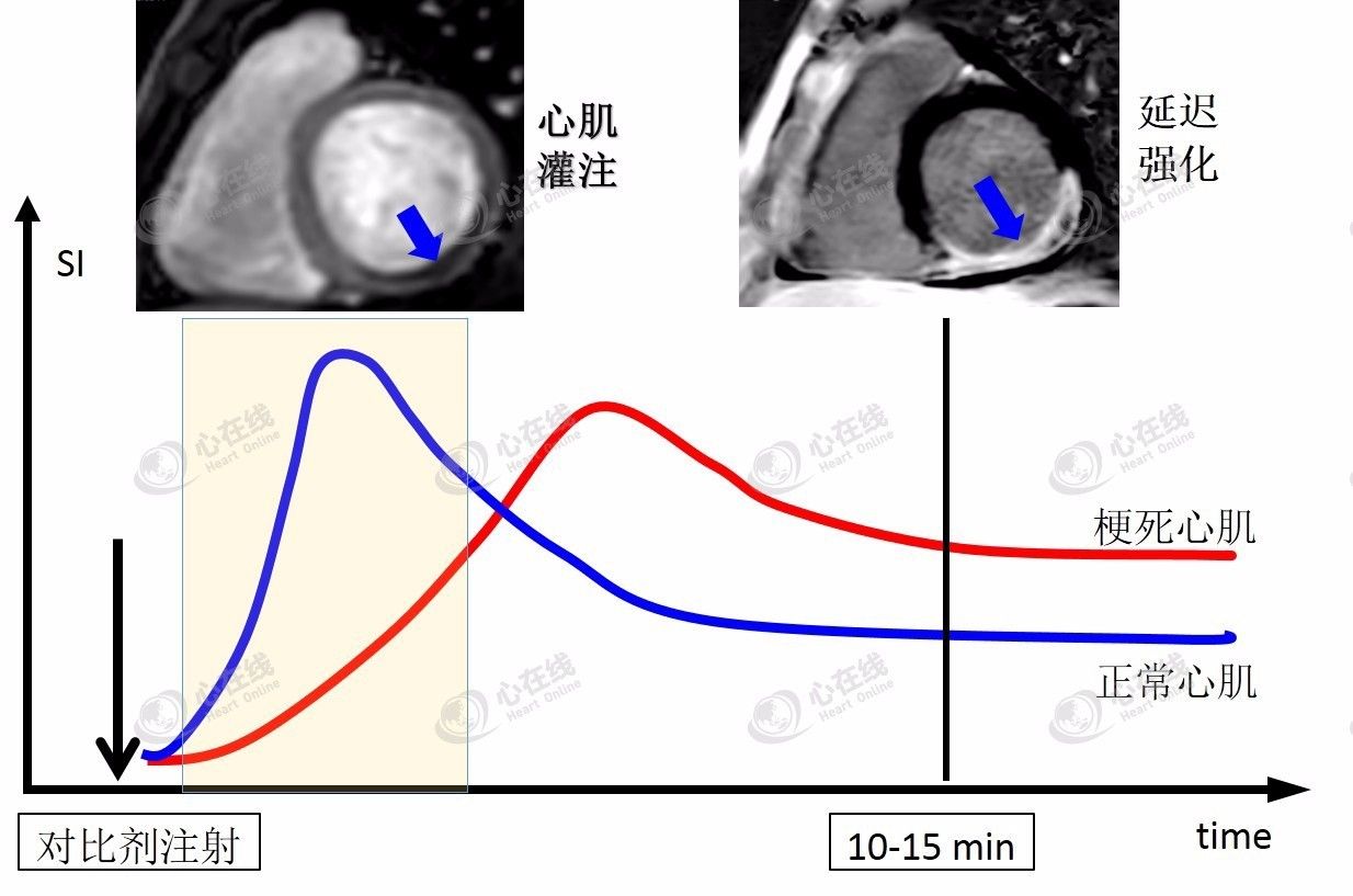 微课堂CMR基础篇：基本扫描序列