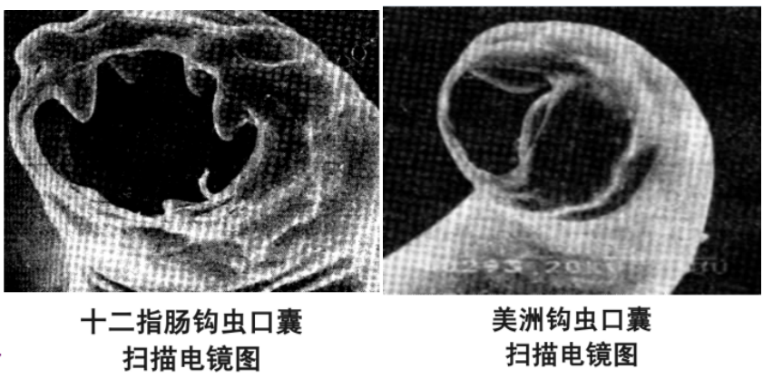 關于寄生蟲，從入門到精通，這一篇就夠了！