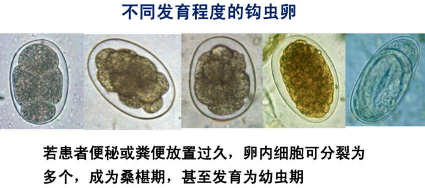 關于寄生蟲，從入門到精通，這一篇就夠了！