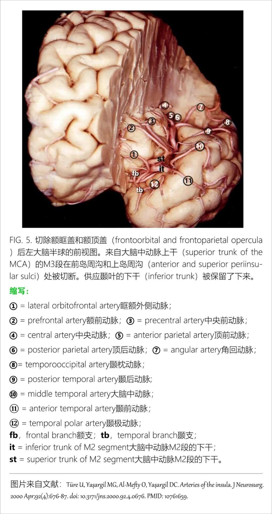 最全整理：脑动脉解剖、分段及供血区图谱
