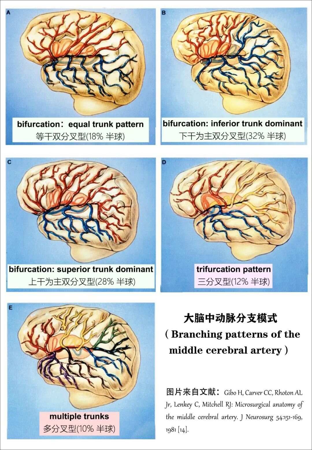 最全整理：脑动脉解剖、分段及供血区图谱