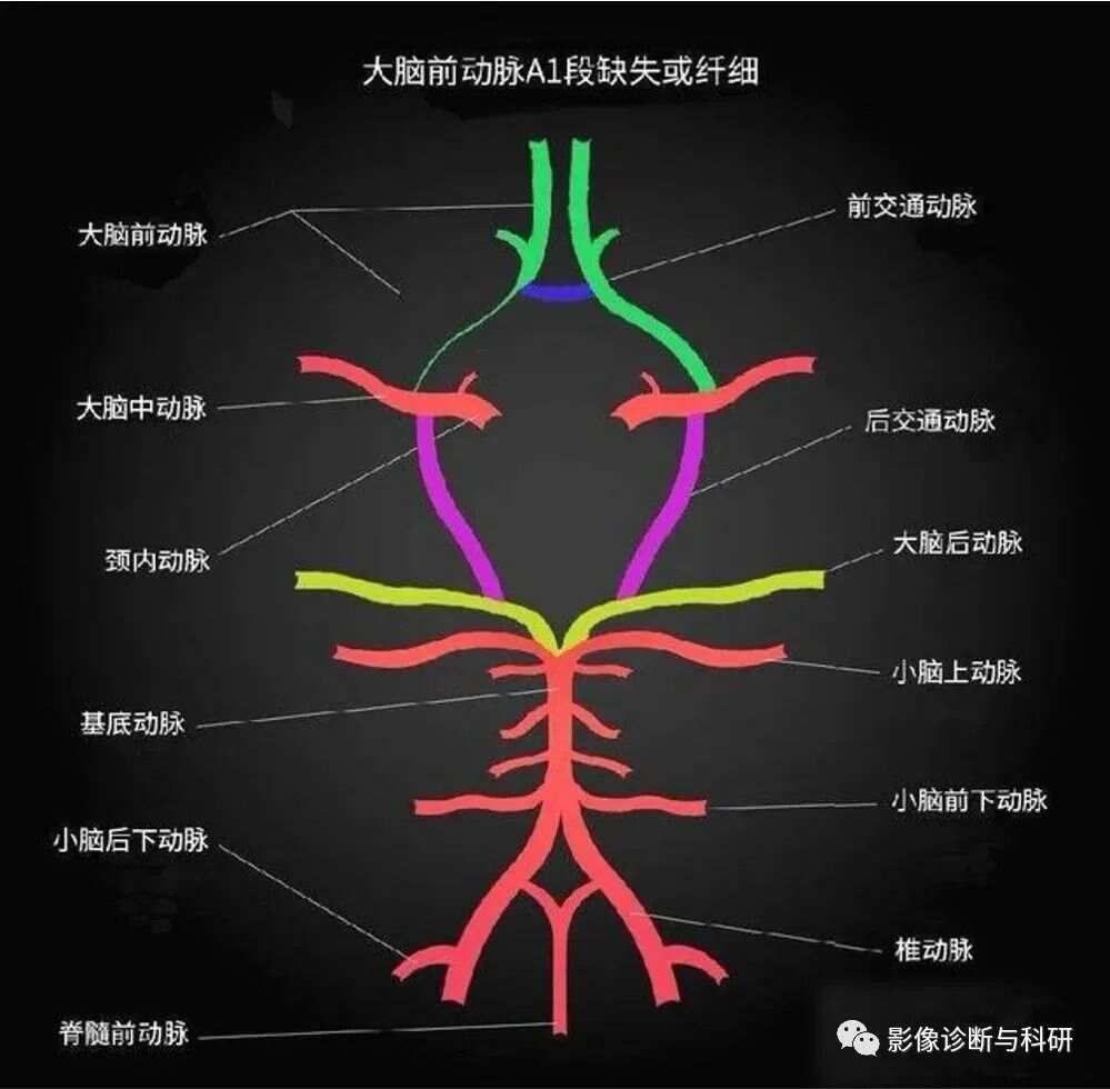 最全整理：脑动脉解剖、分段及供血区图谱
